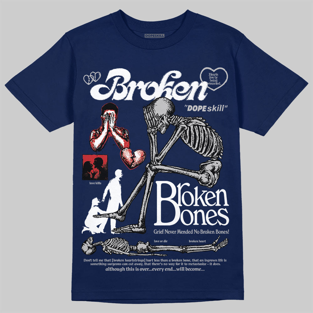 Summit White Navy 4s DopeSkill T-Shirt Broken Bones Graphic